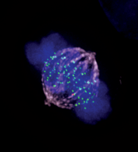 A mitotic human RPE1 cell with a single unattached kinetochore staining for the Spindle Assembly Checkpoint protein, Mad2. Cells are stained to show tubulin in magenta, DNA in blue, kinetochore staining in green, Mad2 in red. Credit: Dr Philippe Collin, The Gurdon Institute, Cambridge.