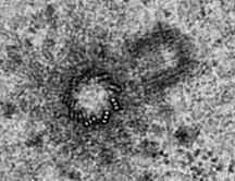 Electron micrograph of a centrosome. Scale bar is 500nm (image is courtesy of Joo-Hee Sir).