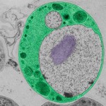 TEM image of Gemmata obscuriglobus, a member of the Planctomycetes bacterial phylum. DNA is colored purple and the vesicle-containing compartment ('cytoplasm') is colored green. The DNA-containing compartment is bordered by one bend membrane. Image provided by Damien Devos.