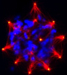 Abnormal mitosis in a cancer cell containing supernumerary centrosomes. Microtubules are red, centrosomes are green and DNA is blue. Scale bar is 10micrometer.