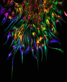 Human blastocyst embryo in culture stained for Nanog (green) and Gata6 (purple). Image credit: Bernard Roelen (Utrecht University).