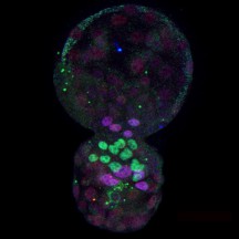 Primary neuronal stem cell culture labelled with markers to differentiate stem cells (orange/yellow) and their progeny (blue/green/purple). Image credit: Hiuxuan Liang and Troy Ghashghaei (North Carolina State University).