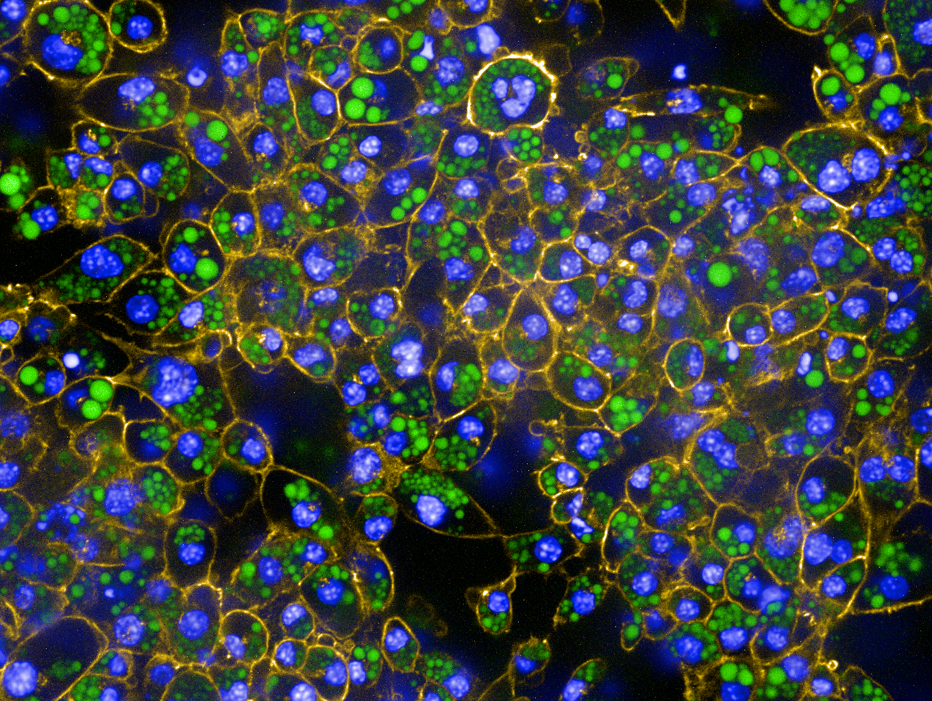 Caption: In vitro differentiated murine brown adipocytes stained for lipids (green), F-actin (red) and DNA (blue). Photo credit: Ruth Karlina and Kenji Schorpp, Helmholtz Zentrum München.
