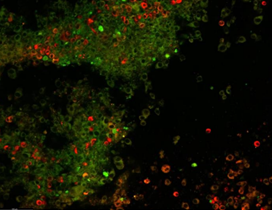 Mice breast tumours with DiBAC (green) and Mitotracker (red) seen through confocal microscopy.