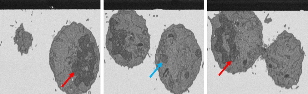 Three electron micrographs showing L996 cells in telophase. 