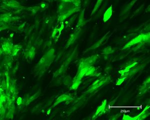 Human fibroblasts viewed down a microscope. They appear green due to a fluorescent marker